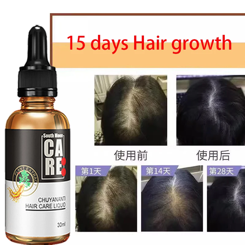 

Anti hair loss hair care and growth liquid hair care and hair enhancement essence hair tonic