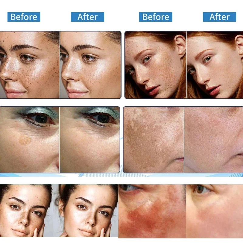 Vitamin C Facial Whitening Serum