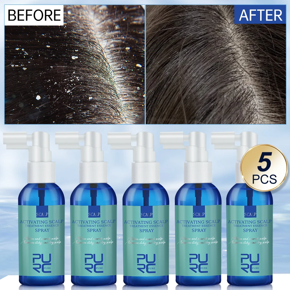 PURC 5PCS Hair Care Dandruff Treatment for Scalp Essence Spray Prevent Itch Oil Control Hair Loss Hair Oil Product Beauty Health