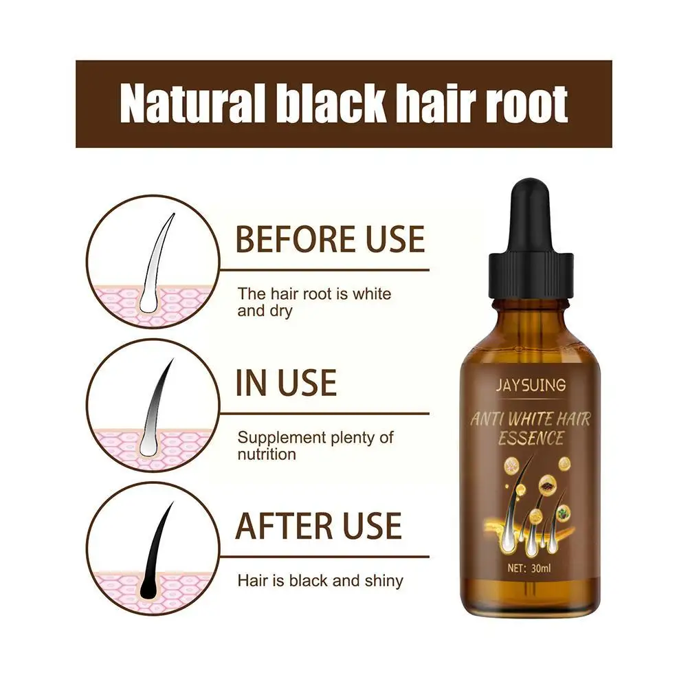 30ml Hair Care Black Hair Spray Essence Reverse Grey Treatmnt Serum Anti Loss Repair Spray Men Women Healthy