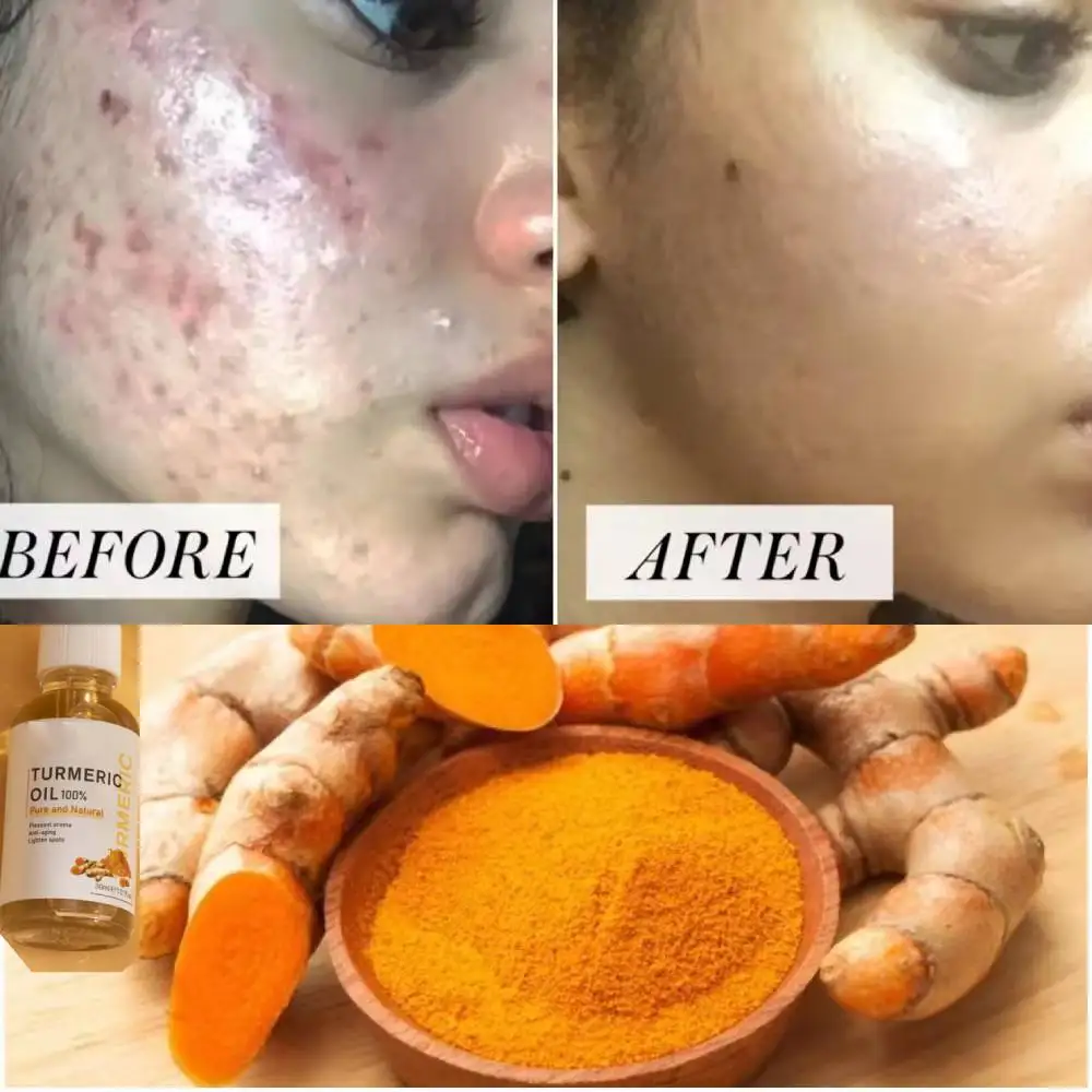 TurmericVitaminCOilSerumExtractwithGingerLemonOilFace