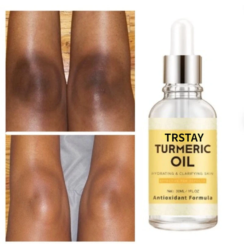 New Turmeric Oil Glow to Facial Lightening Serum For Black Brown Skin Leg Hand Body Whitening for Dark Skin beauty health