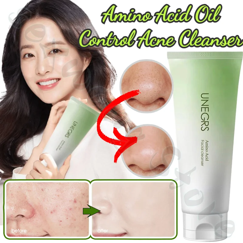 Amino Acid Moisturizing and Oil Controlling Blackhead Cleanser Shrinking Pores and Brightening Skin Color Facial Cleanser 120ml