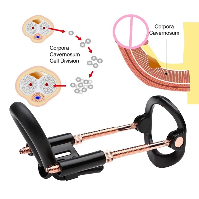Generation Male Enlarger Stretcher Tension Traction