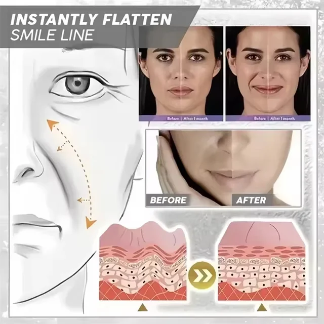 Crema antietà al veleno d'api Ringiovanisce la pelle del viso Idratazione profonda Dissolvenza Linee Assorbimento rapido Riparazione Rughe istantanee Cura della pelle 4