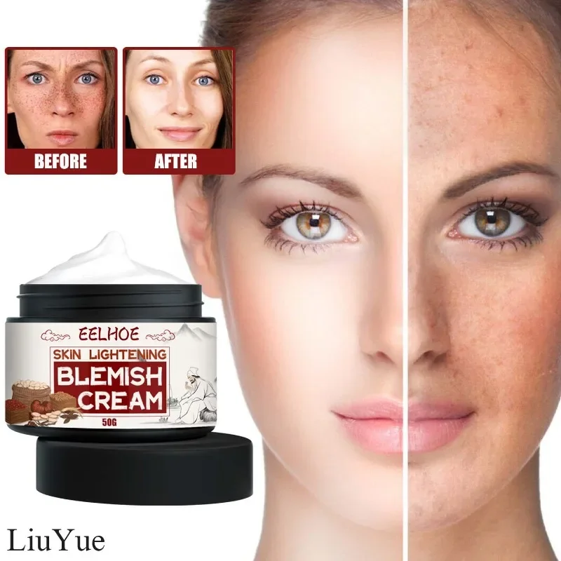 Face Melasma Remover for Women Remove Melanin Dark Spots Cream Whitening Removal Freckles Cream Fade Spots Skin Brightening Care whitening face cream for brightening smoothing skin remove spot reduces melanin produced by skin oxidation glutathione cream