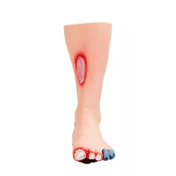 Anatomical Foot Model Diabetic Care Gangrene Ulcer Nursing Teaching Simulator