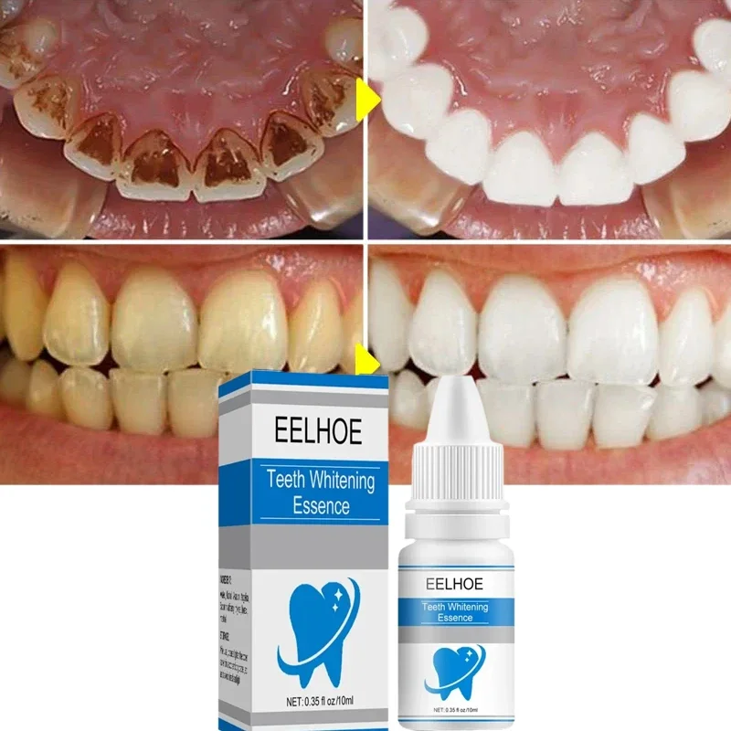 

Remove Plaque Stains Serum Teeth Whitening Fresh Breath Oral Hygiene Against Dental Caries Dental Tooth Cleaning Tools 2024