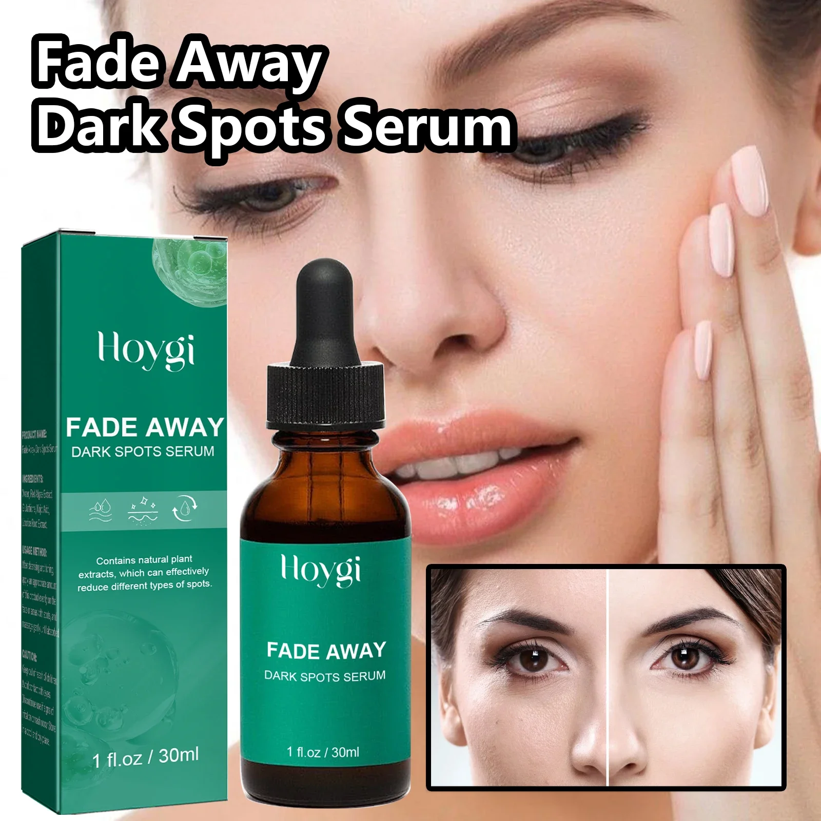 Dark Spot Remover Serum For Face Sun Melasma Freckles Pigment Age Spots Removal Freckle Whitening 3