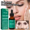 Dark Spot Remover Serum For Face Sun Melasma Freckles Pigment Age Spots Removal Freckle Whitening 3
