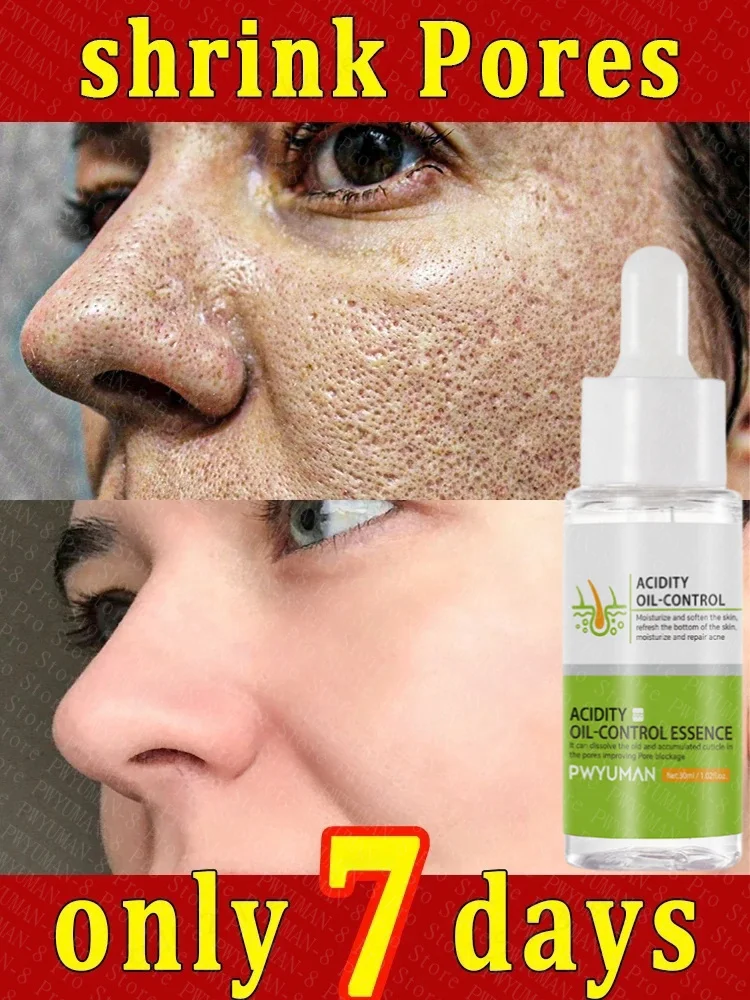 PoresRemoverPoreShrinkingSerumShrinkTighteningFacialSerumAcne