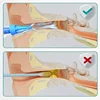 Ear Cleaner Irrigation Kit Ear Wax Removal Tool Water Washing Syringe Comfortable Unique 12/20ML Health Care 3