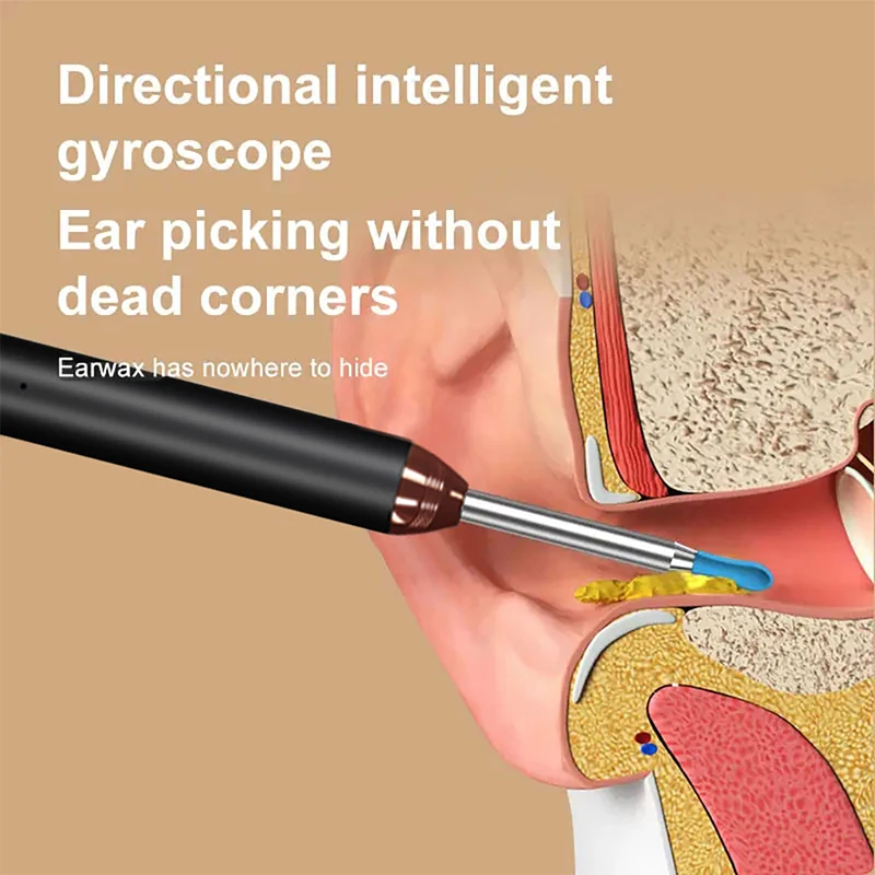 visual ear cleaner Tinsol Smart Visual Ear Cleaner 1296P Ear Sticks Otoscope USB C Charging Endoscope Wax Removal Tool Earpick Camera Health Care