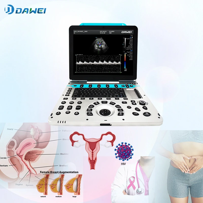 Dawei DW P50 портативный 3D 4D Цветной Допплер