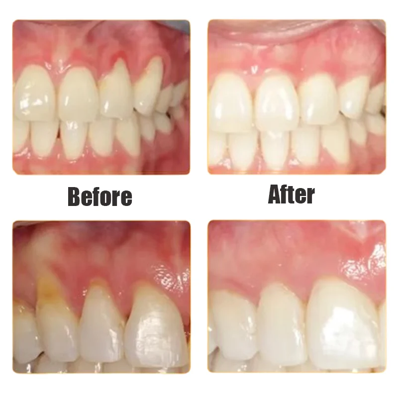 Gum Repair Drops Rapid Repair Gums Serum Relieve Tooth Allergy Dental Caries Tooth Cleaning Toothpaste Effectively Relieve Damage Drops