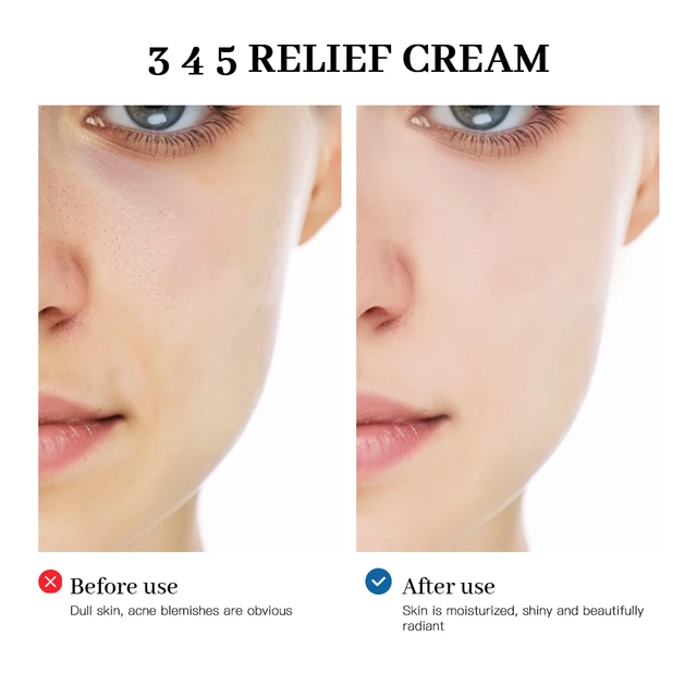 345 Relief Cream Comprehensive solution to skin problems Anti-sugar and antioxidant Brightening skin Improving acne marks Moistu 3