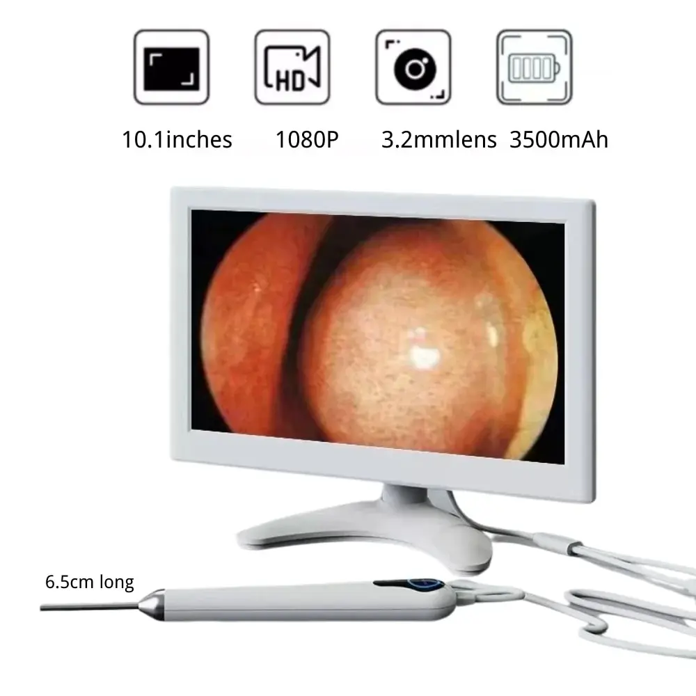 Digital Otoscope 10.1 Inch 3.2mm Digital Otoscope 1080P HD Ear Scope ENT Endoscope Ear Cleaner Tools With 3500mAh Rechargeable Battery