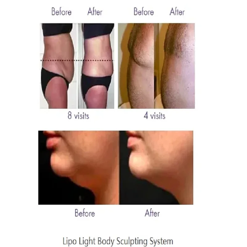Lipo Laser ems tens Machine Weight Loss Fat Burning Body Anti Cellulite Firming Skin Lifting Shaping Slimming Beauty Instrument