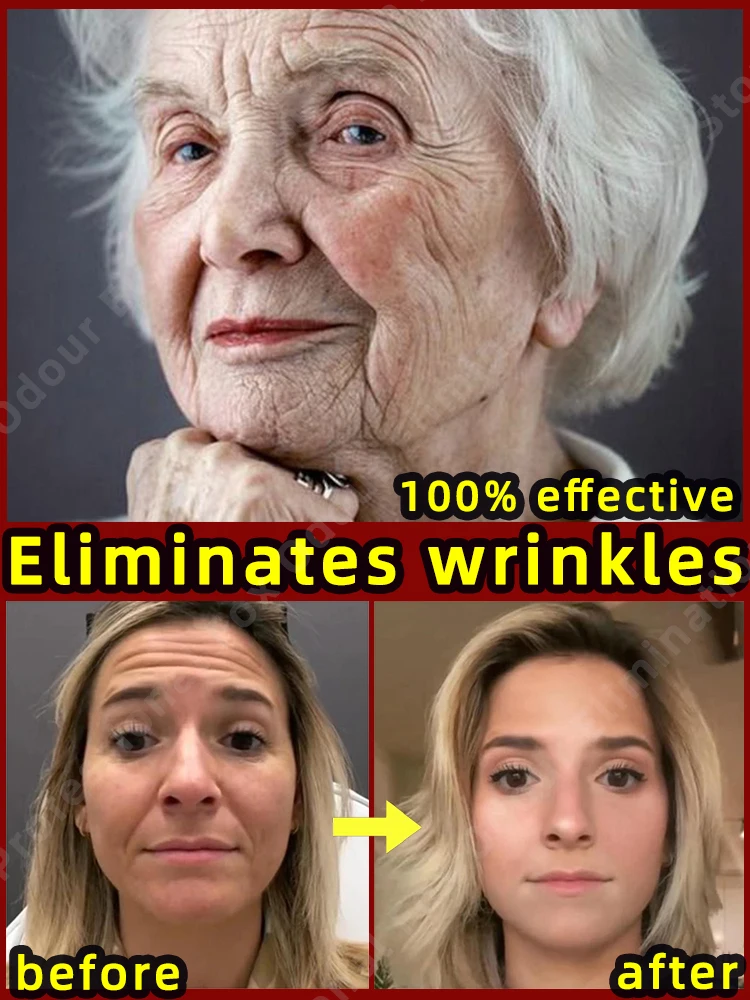 Anti-wrinkle Serum Remove Face Neck Forehead Wrinkles Anti-aging Skin Firming Products 5