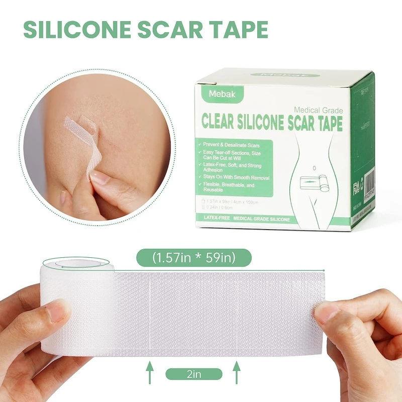 Mebak Silicone Scar Sheets 1.6x60 Inch Scar Repair Tape Roll Clear Scar Removal Strips For Keloid And C-Section Surgery Keloid