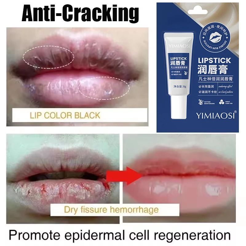 إزالة بلسم الشفاه الداكن سريع التفتيح الوردي الشفا...