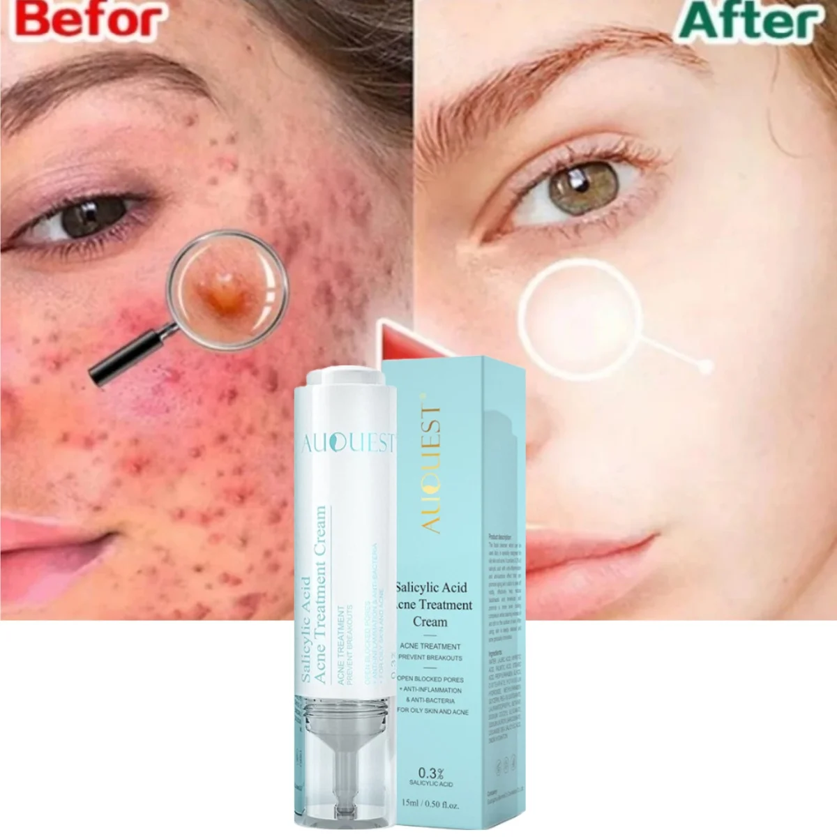 

Salicylic Acid Acne Treatment Face Serum Pore Shrinking Smooth Moisturizing for Sensitive Skin Oil Control Press Skincare Lotion