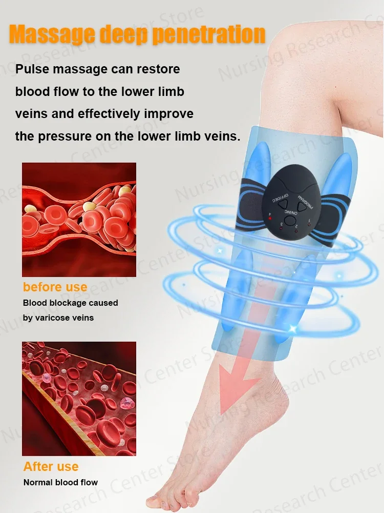 Vene Varicose Vaso Sanguigno Blu Visibile Attraverso La Pelle Gamba - Foto 7