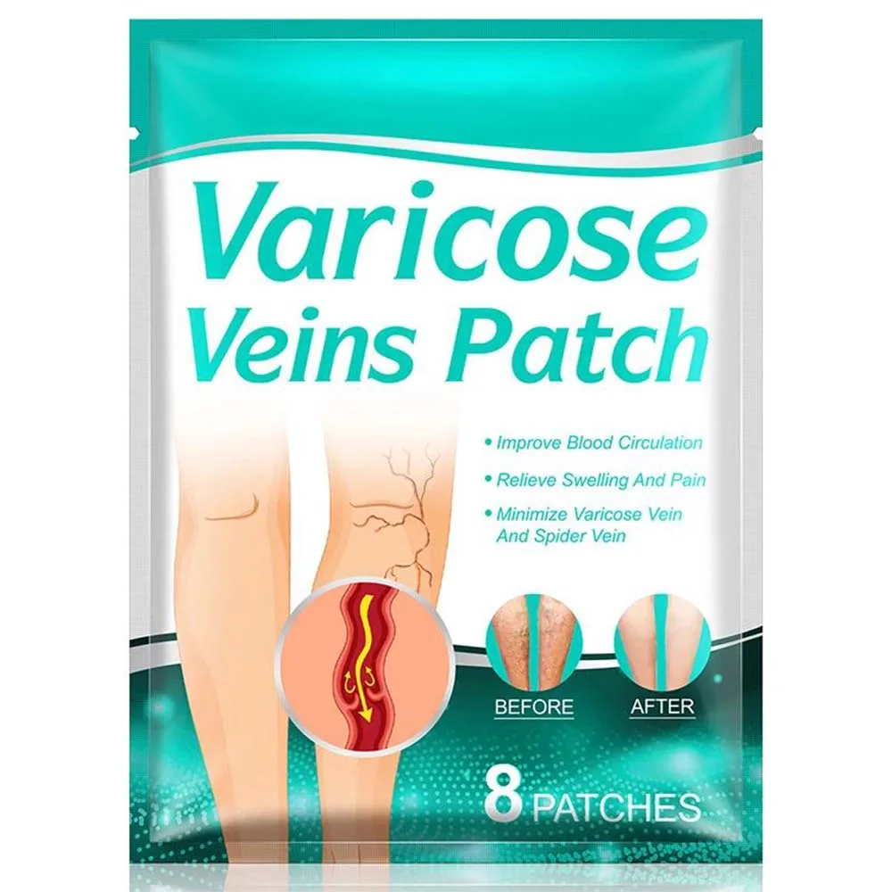 Z20 10PCS Varicose Veins Patch Treatment For Varicose Veins Vasculitis Phlebitis Spider Leg Medical Patch Angiitis Removal