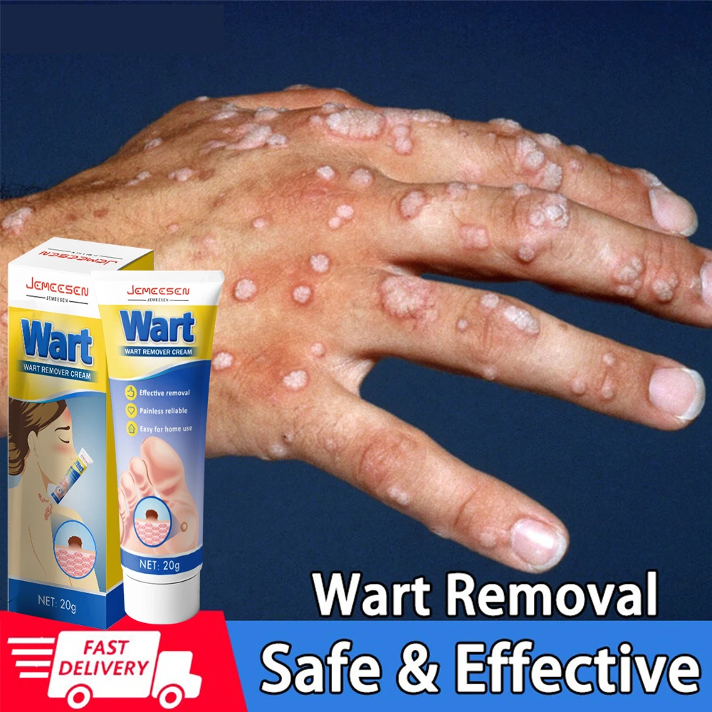 Jemeesen Removing Against Skin Tag Wart Mole Anti Verruca Remedy Cream
