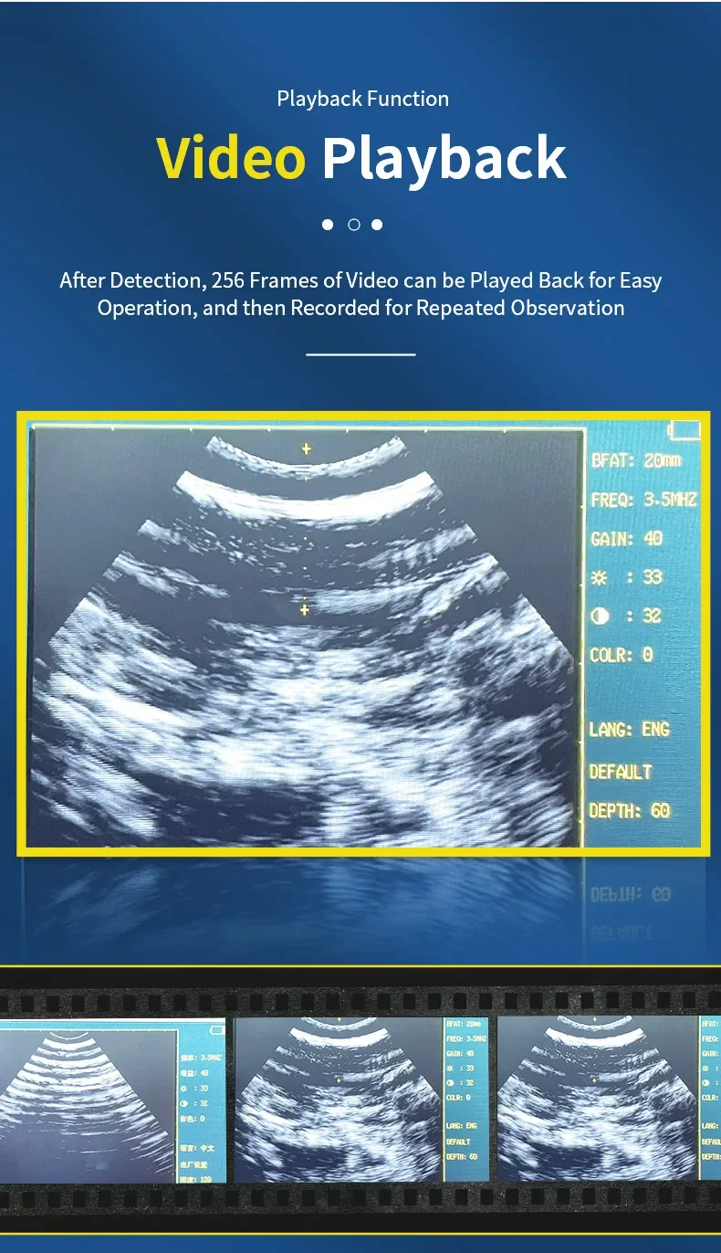 Portable Veterinary Ultrasound Scanner For Dog Cat Cattle Cow Pig Horse Ultrasou