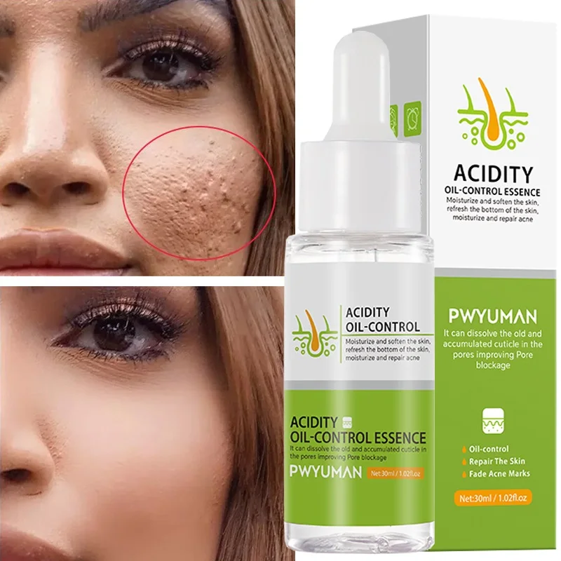 

Pore Shrinking Serum Pores Treatment Moisturizing Relieve Dryness Oil-Control Firming Repairing Soften Smooth Skin Care