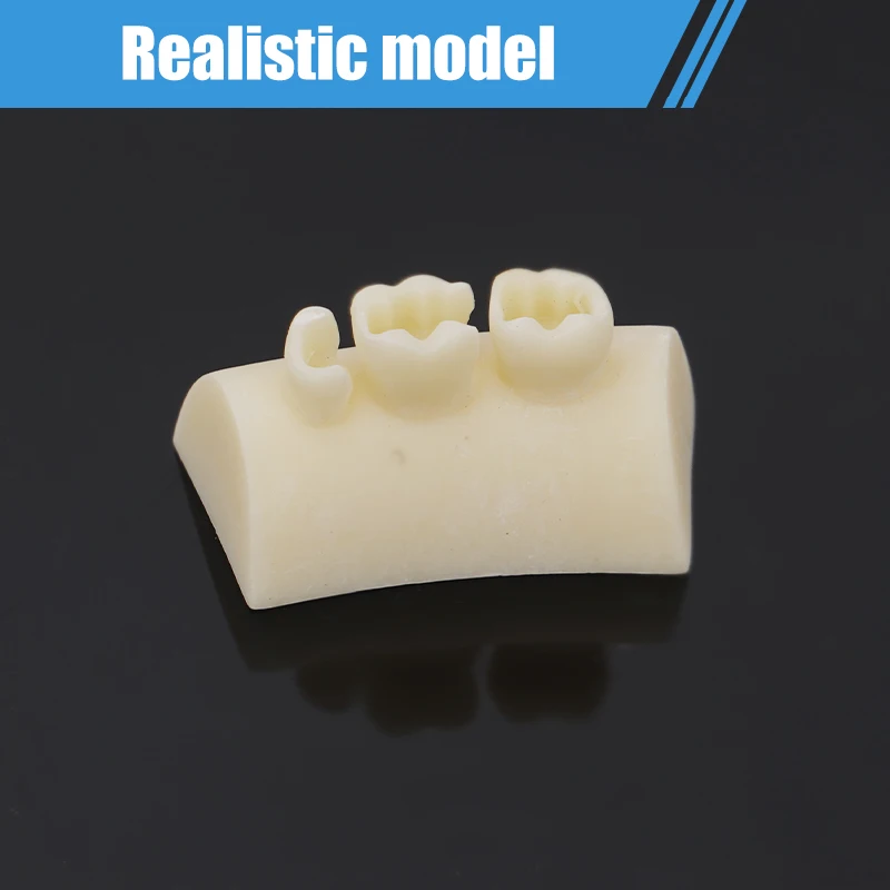 1PC 치과용 인레이 연습 모델 블록 복합 레진 충전 연습 모델 구강 충전 티포돈트 모델 학생 교육용