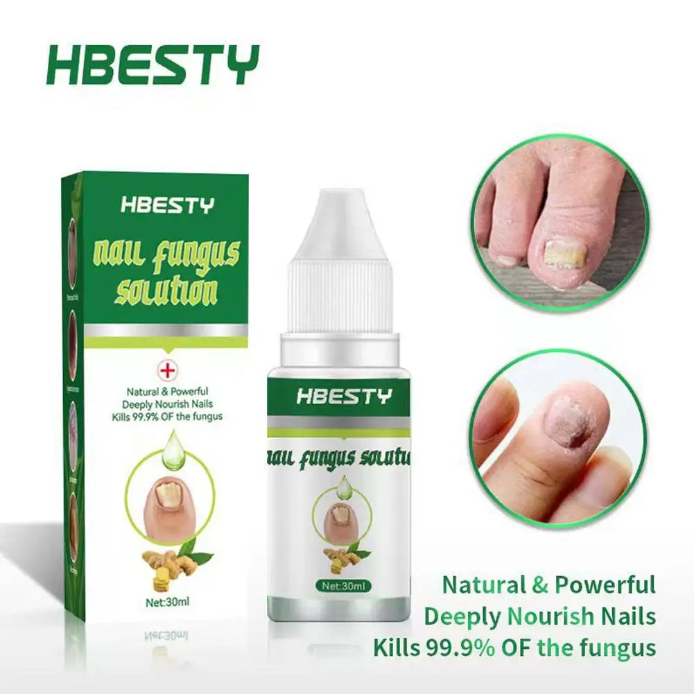 

30 мл серый Уход за ногтями Лечение грибка ногтей устранение проблем с ногтями Различные разделения питательный ремонт ногтей S3N1