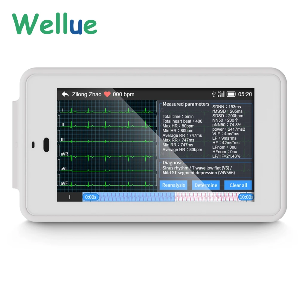 Wellue PC-ECG500 Pocket Ecg Monitor With Glasgow Analysis 6/12-lead Synchronous Acquisition Electrocardiography Ecg