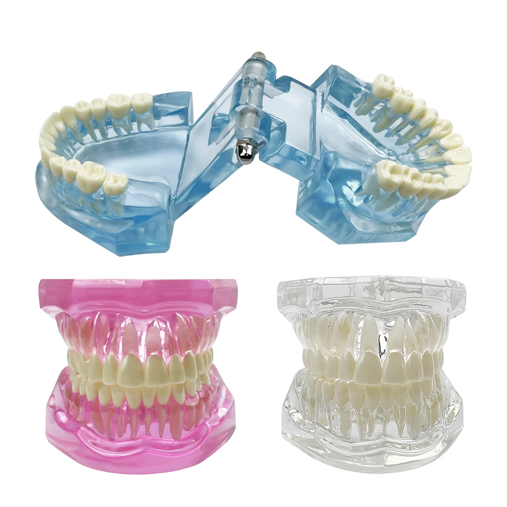 1개 일반 치과 모형 치아 치과 교육 모형 투명 블루 핑크 치과 교육 및 훈련 시연용