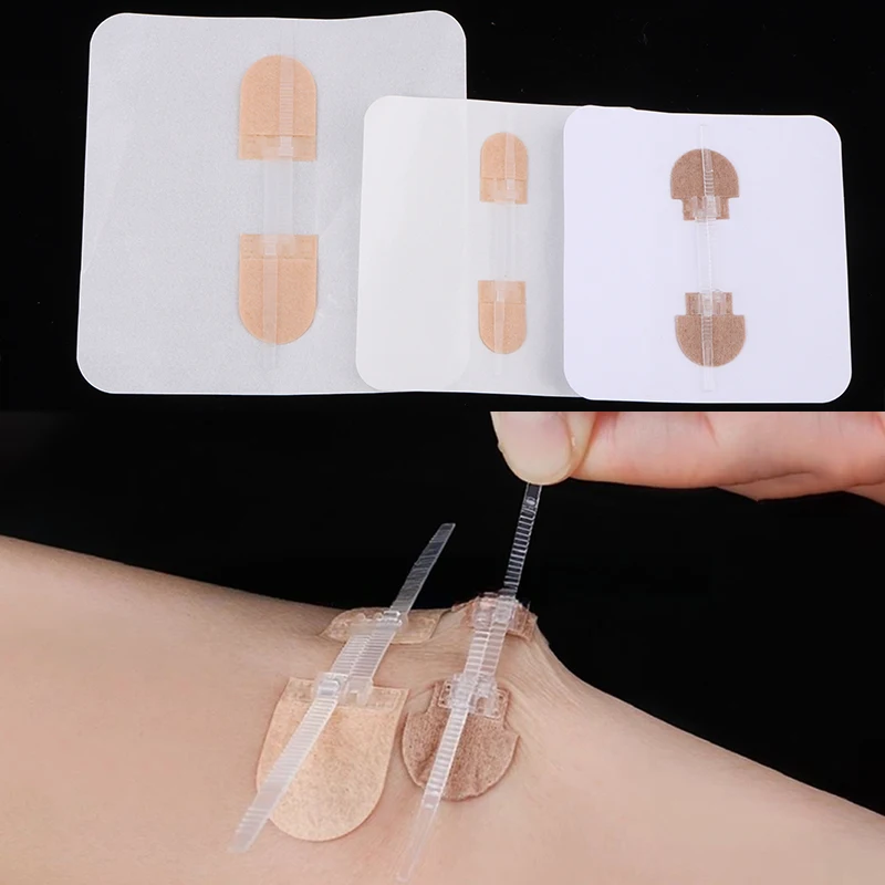 Suture Zipper Band-Aid Zipper Tie Wound Closure Patch Hemostatic Patch 1Pcs wound bandage medical wound dressing