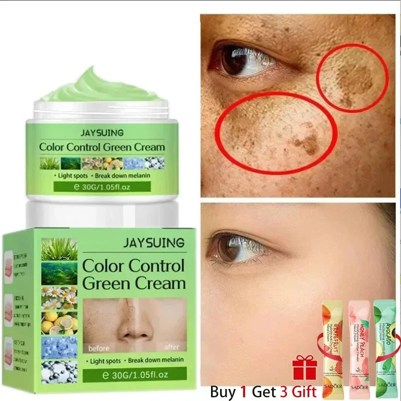 Face Cream Remove Melasma Dark Spots Lighten Melanin Remover Moisturizing Brightening Face Smooth Skin Korean Care Product 30ML