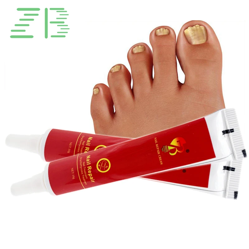 

10g High-quality Nail Fungus Treatment Repair Feet Care Cream Anti Infection Onychomycosis Foot Toe Nail Fungal Removal Ointment