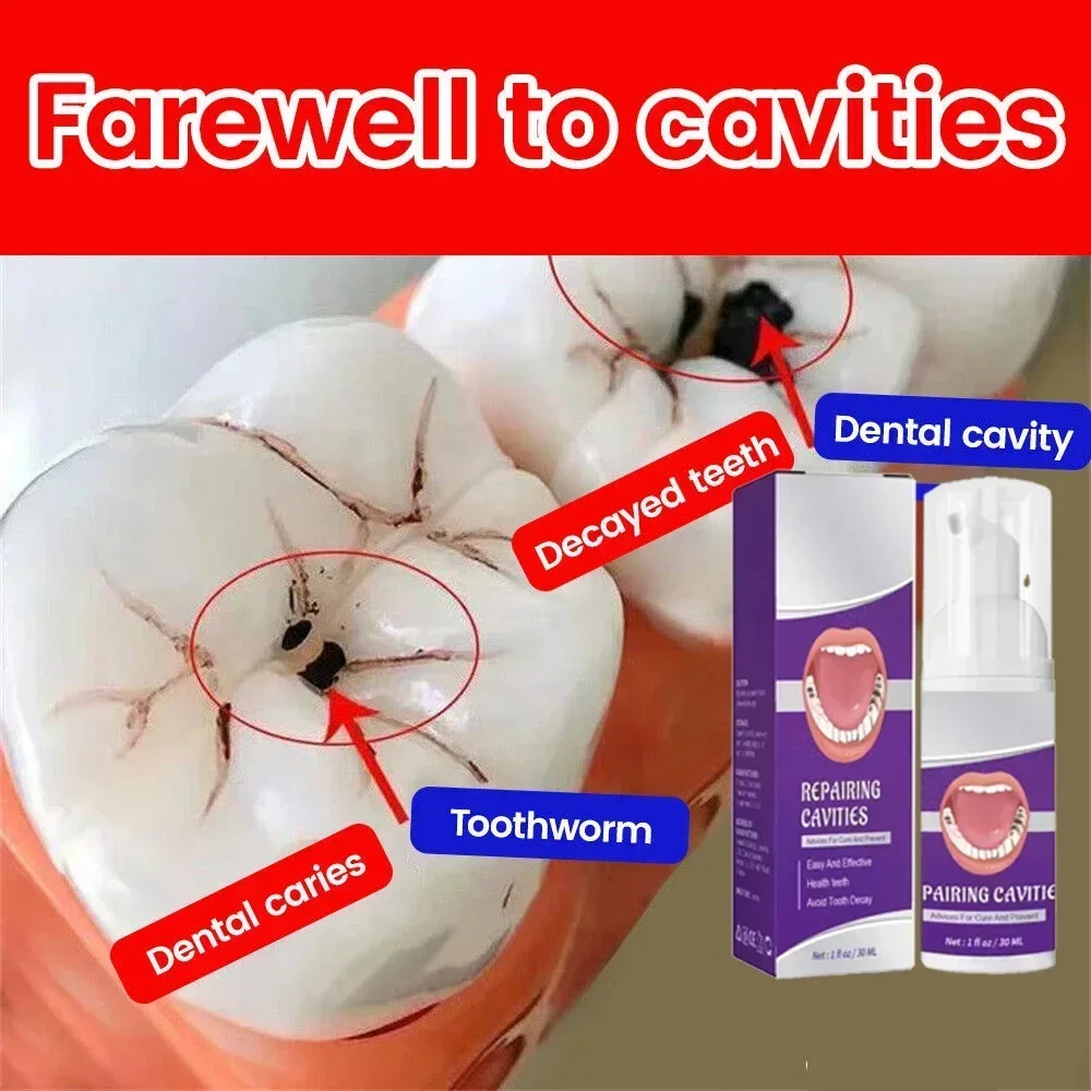 Effective Teeth Whitening Tooth decay repair Calculus Plaque Periodontitis Remove Cavities