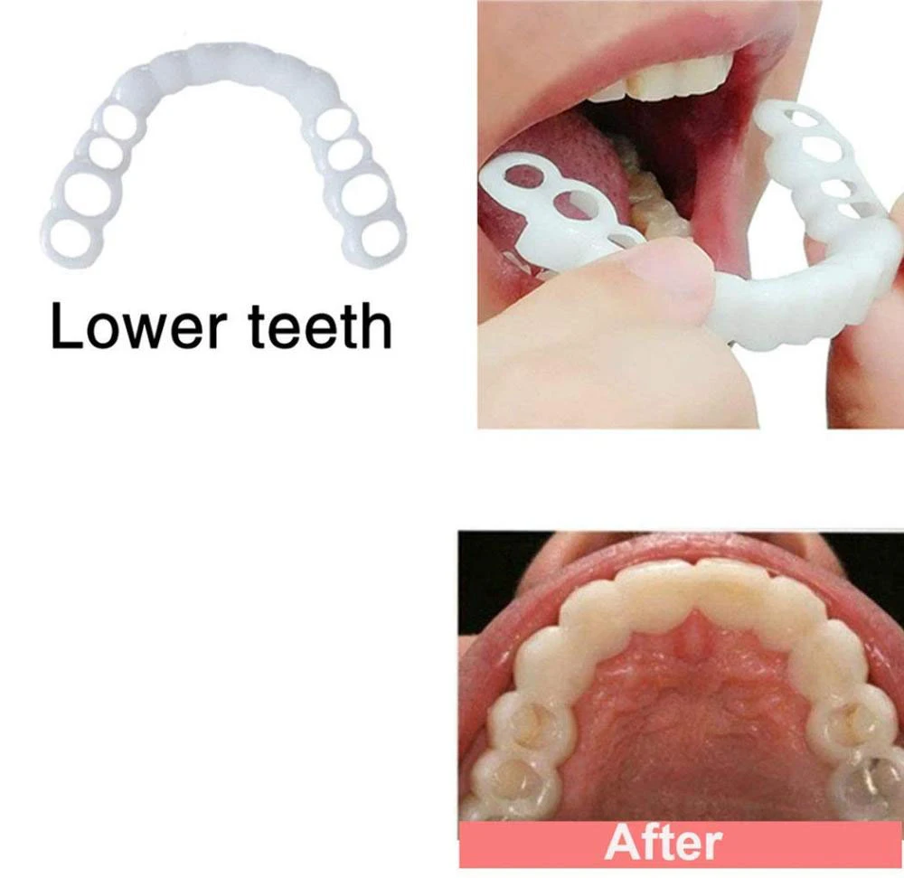 Peut T On Blanchir Des Fausses Dents Sourire parfait, couverture de fausses dents, placages de fausses dents,  dents blanches, blanchiment des dents, couverture des dents, soins  cosmétiques de la prothèse dentaire 01 | AliExpress