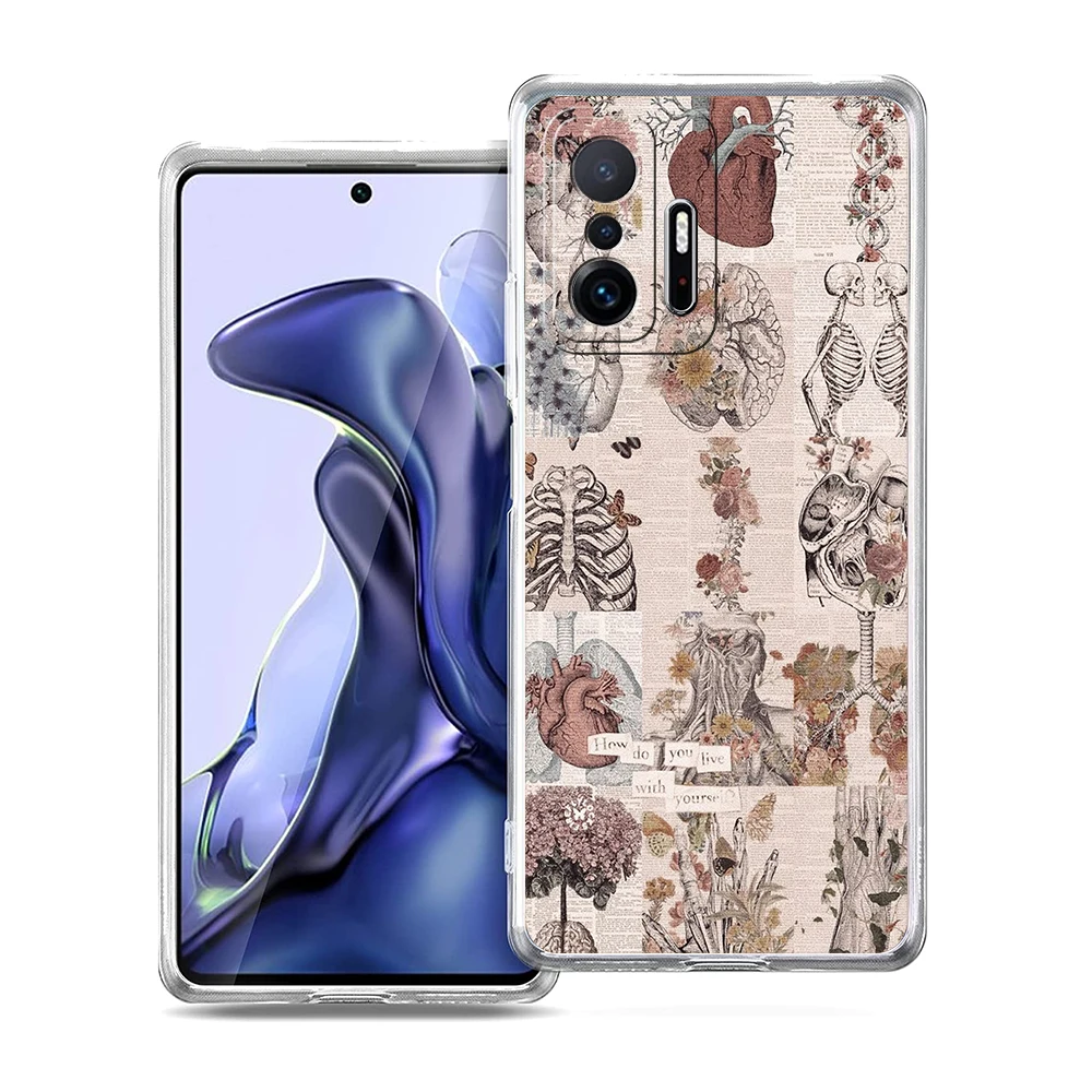 Transparent Soft TPU Shell with Anatomy Skeleton Chalkboard Heart Design