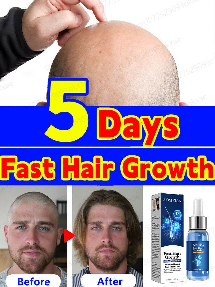 HairGrowthOilFastHairGrowthEffectiveBaldnessRepairHereditary