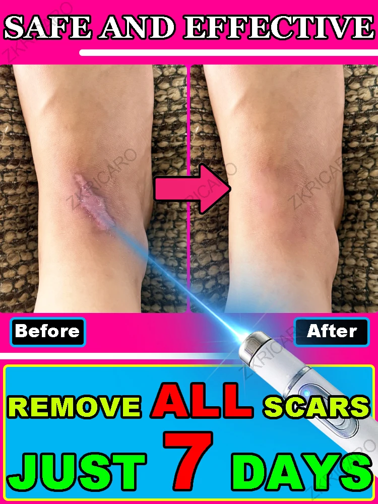 Gentle repair, scar killer!