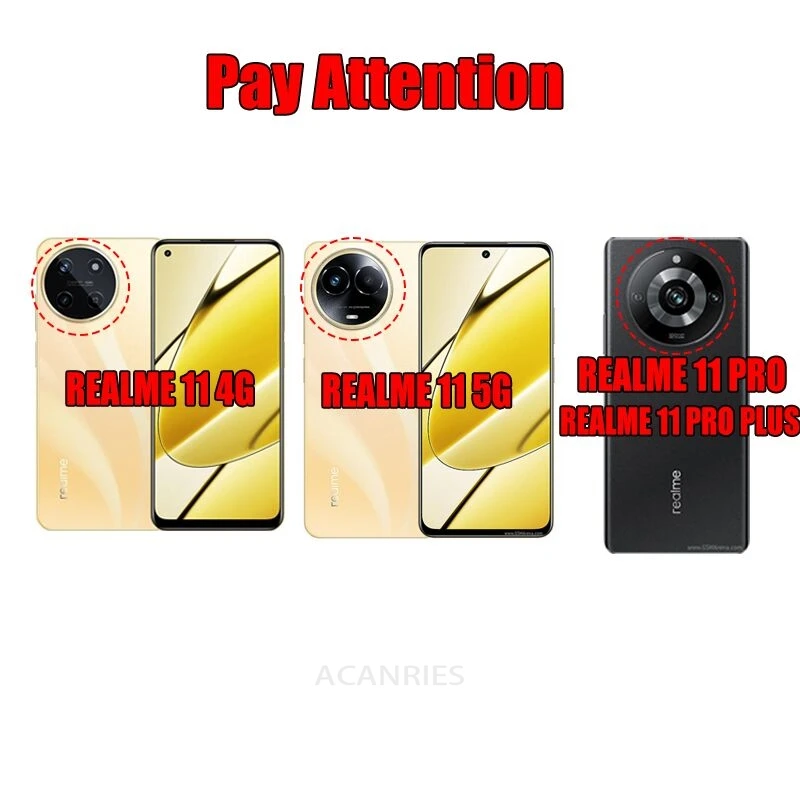Luxury Plating Lanyard Silicone Phone Case - Elegant Protective Back Cover