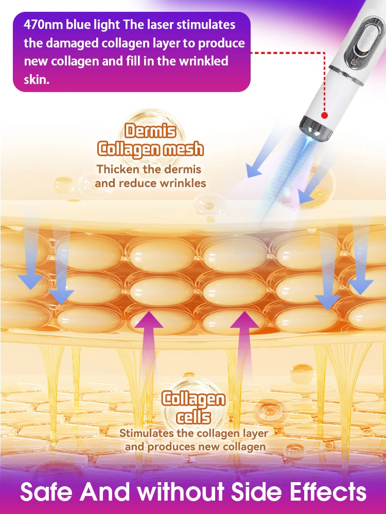 Wrinkle remover Erase Wrinkles in Just 7 Days