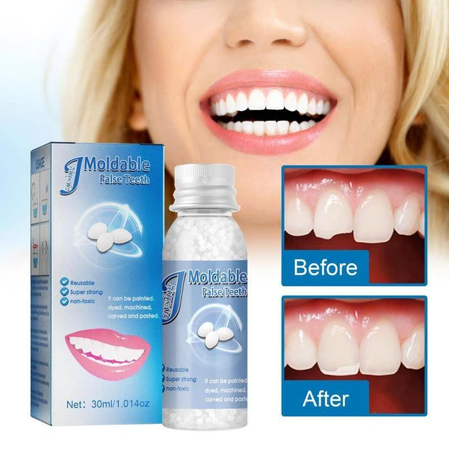 Moldable False Teeth, Tooth Repair Granules, Tooth Beads