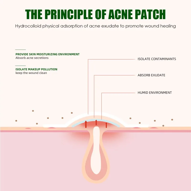Acne pimple patch blackhead remover acne remover invisible waterproof absorb pus acne pimple remover tool cleaner Korean skin care product