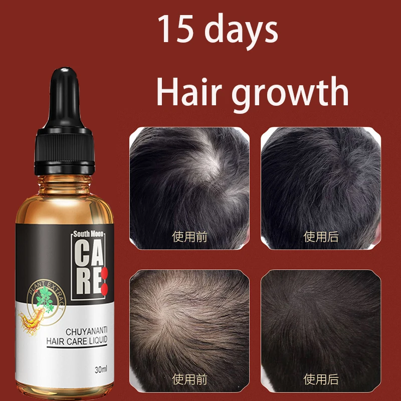 

Anti hair loss liquid hair growth agent for dense hair growth, hairline growth liquid for hair enhancement