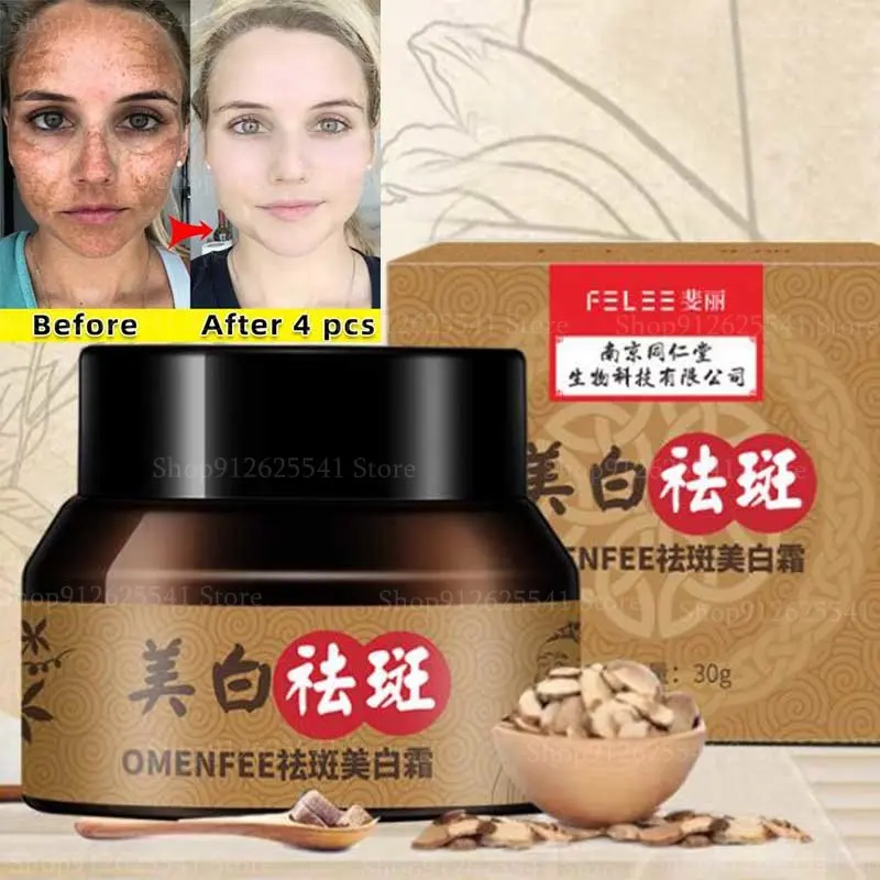 Facial Spots Skin Dark Spot Freckles Remove Cream Melanin Anti-Pigmentation Improve Dullness Fast Whitening Freckles Cream