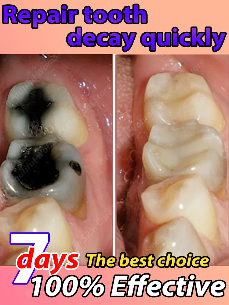 Clean cavities, whiten teeth, remove plaque, treat periodontitis, freshen breath, and let the whole family have good teeth
